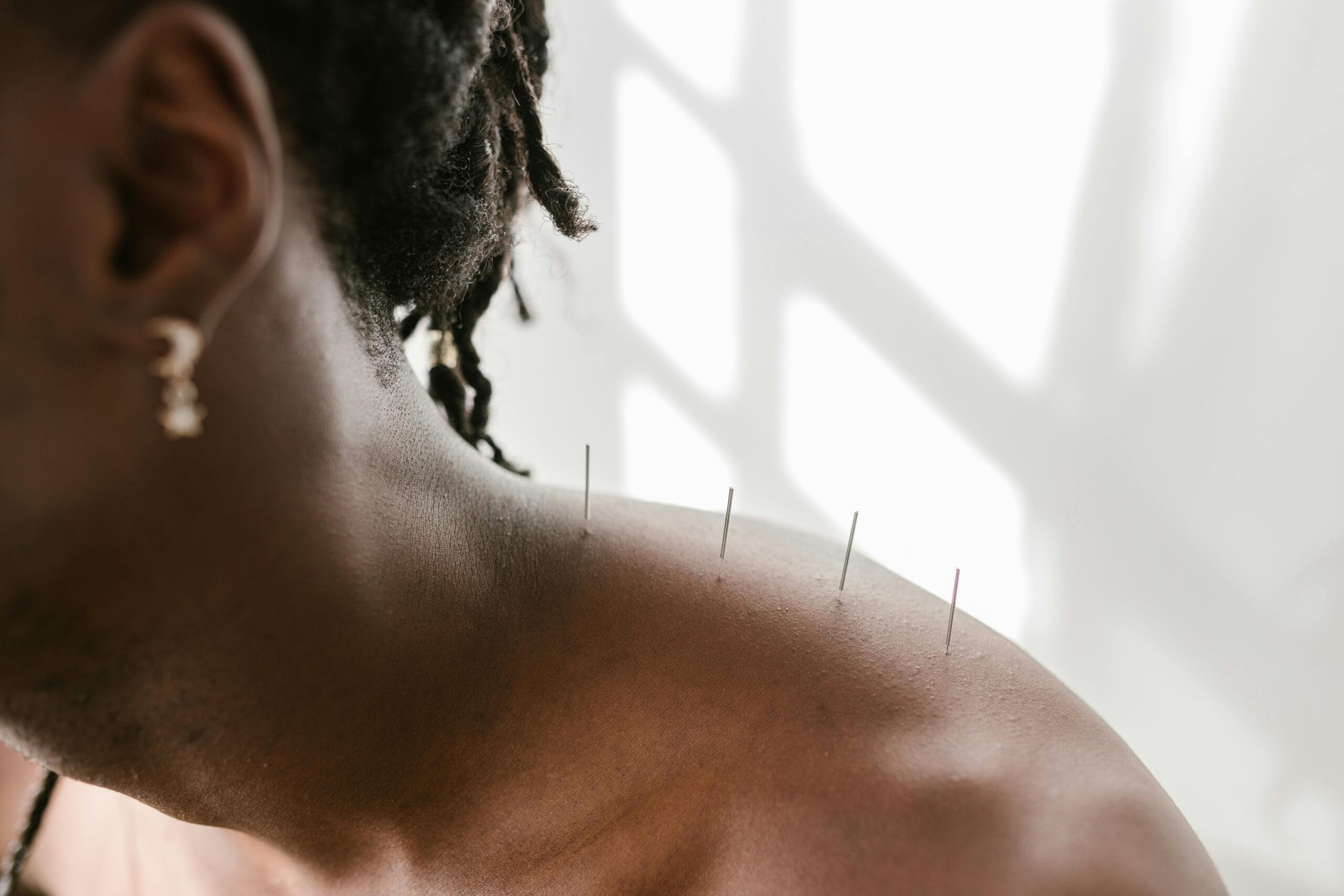 Acupuncture pour menopause